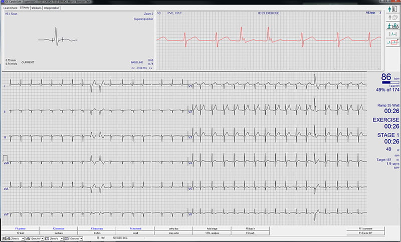 CardioSoft ECG | Vyaire Medical